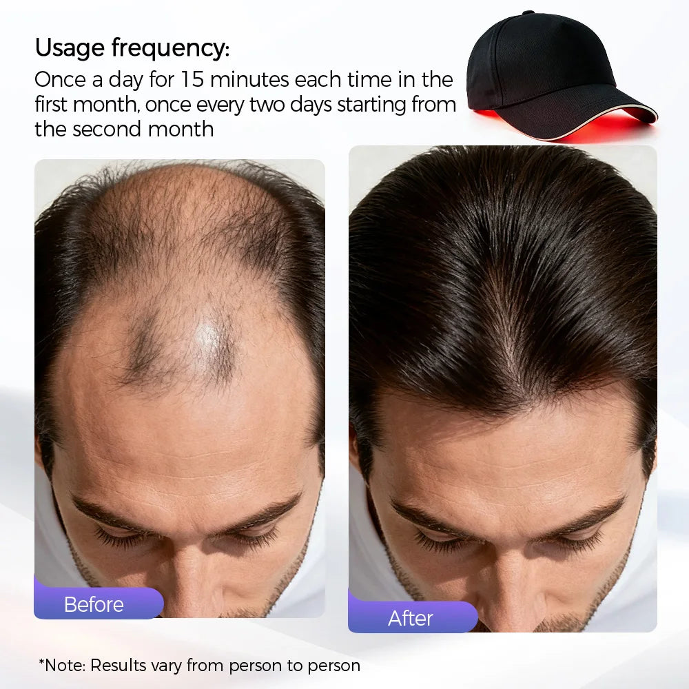 210 LED Red Light Therapy Cap Hair Growth Laser Cap 470Nm 630Nm Infrared Scalp Treatment Hat Hair and Scalp Treatments anti Hair