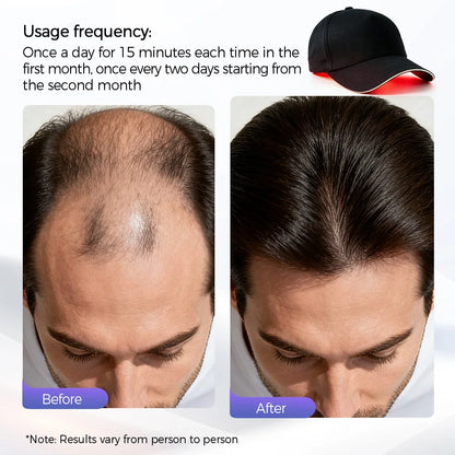 210 LED Red Light Therapy Cap Hair Growth Laser Cap 470Nm 630Nm Infrared Scalp Treatment Hat Hair and Scalp Treatments anti Hair